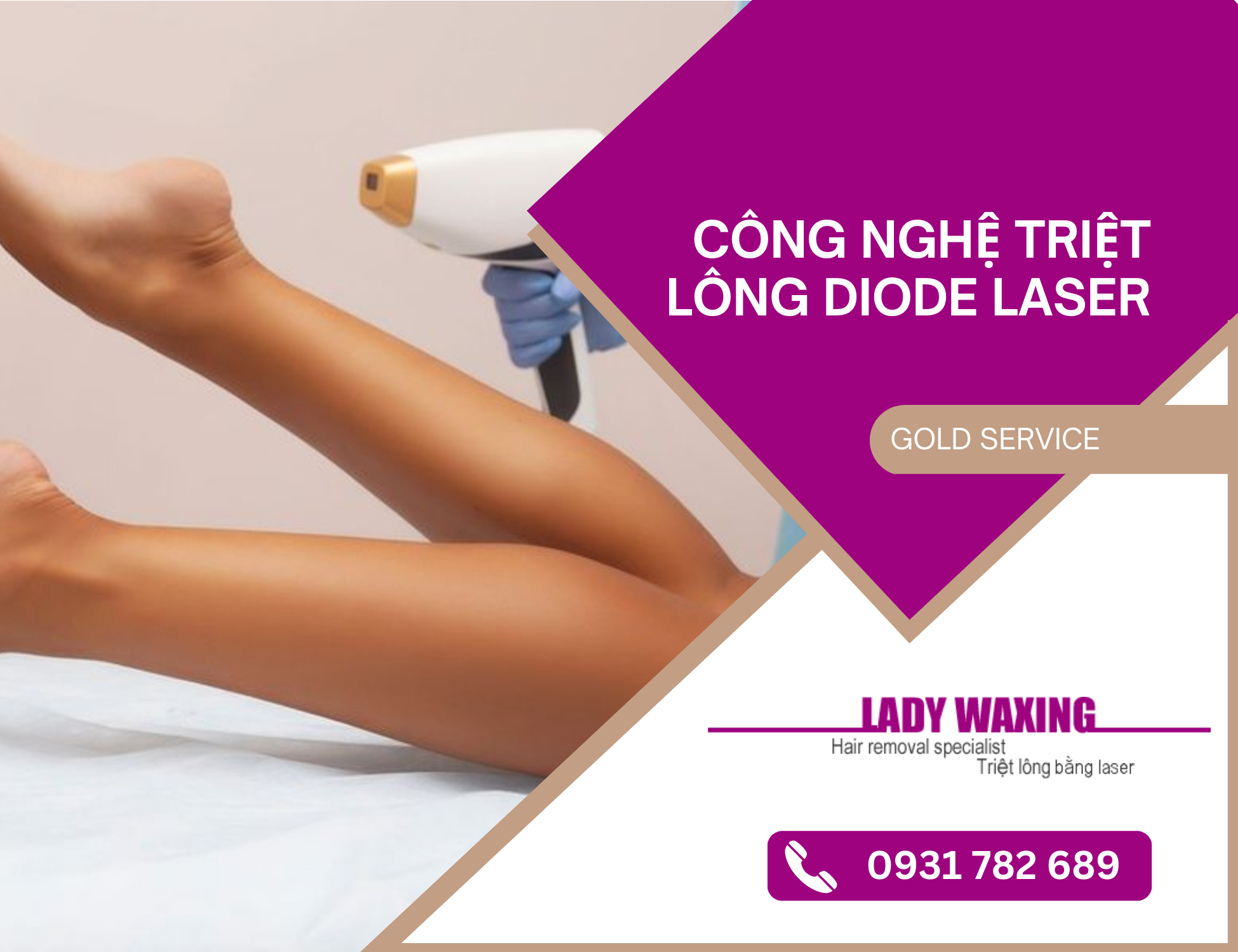 triệt lông bằng diode laser