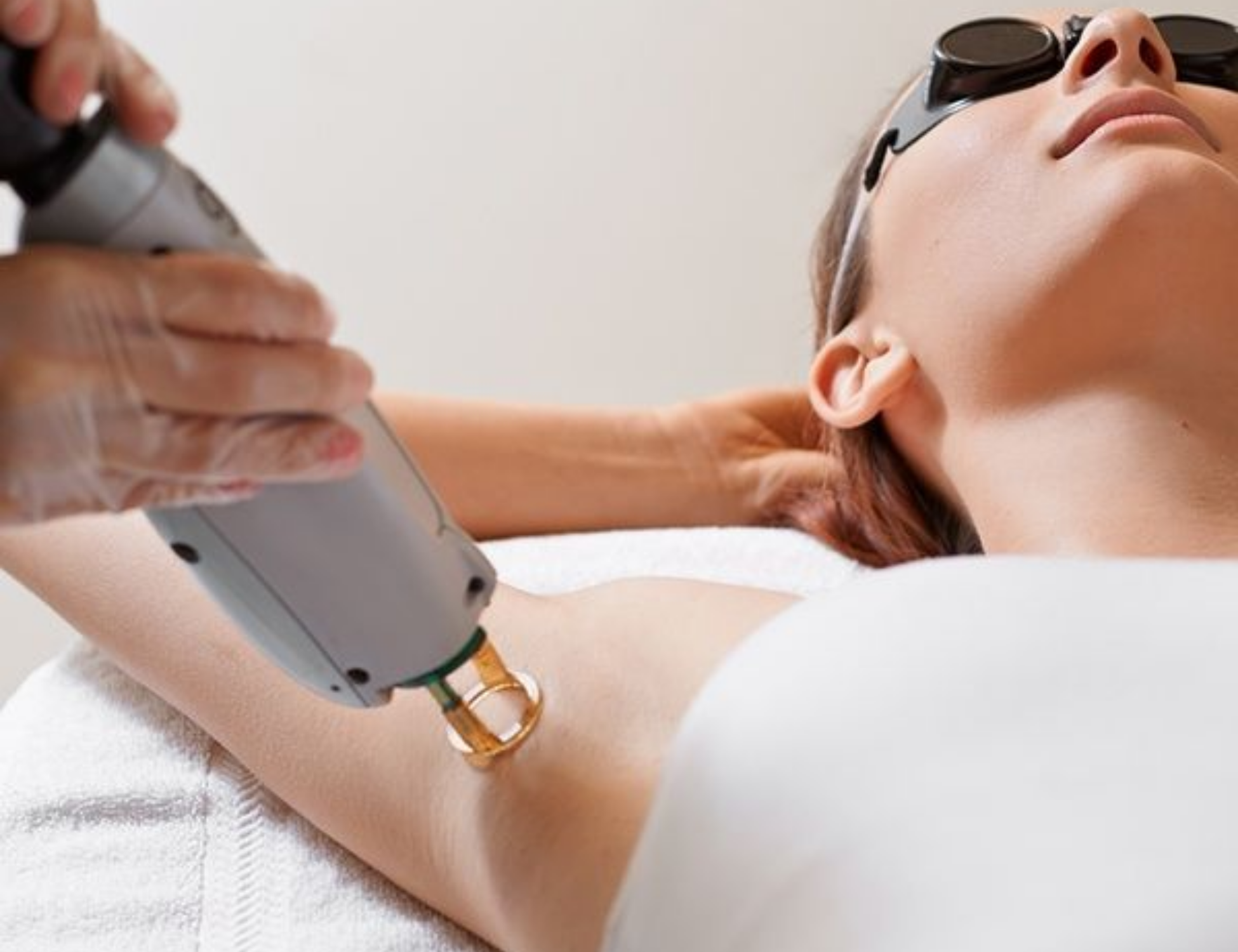 triệt lông bằng công nghệ diode laser